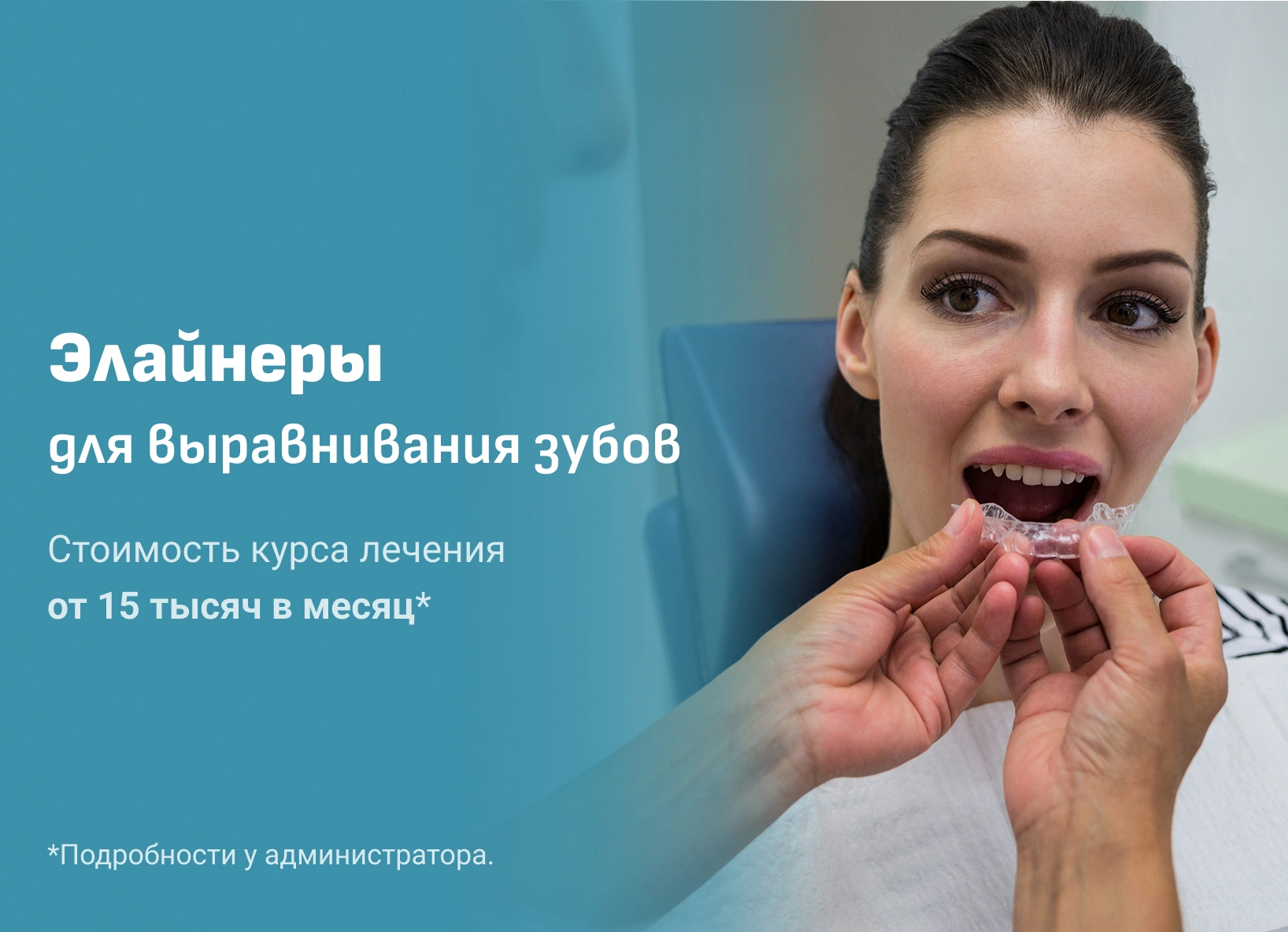 Элайнеры для выравнивания зубов